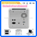 MSLPU01-I Cheapest hospital Equipment laptop ultrasound machine/portable ultrasound scanner